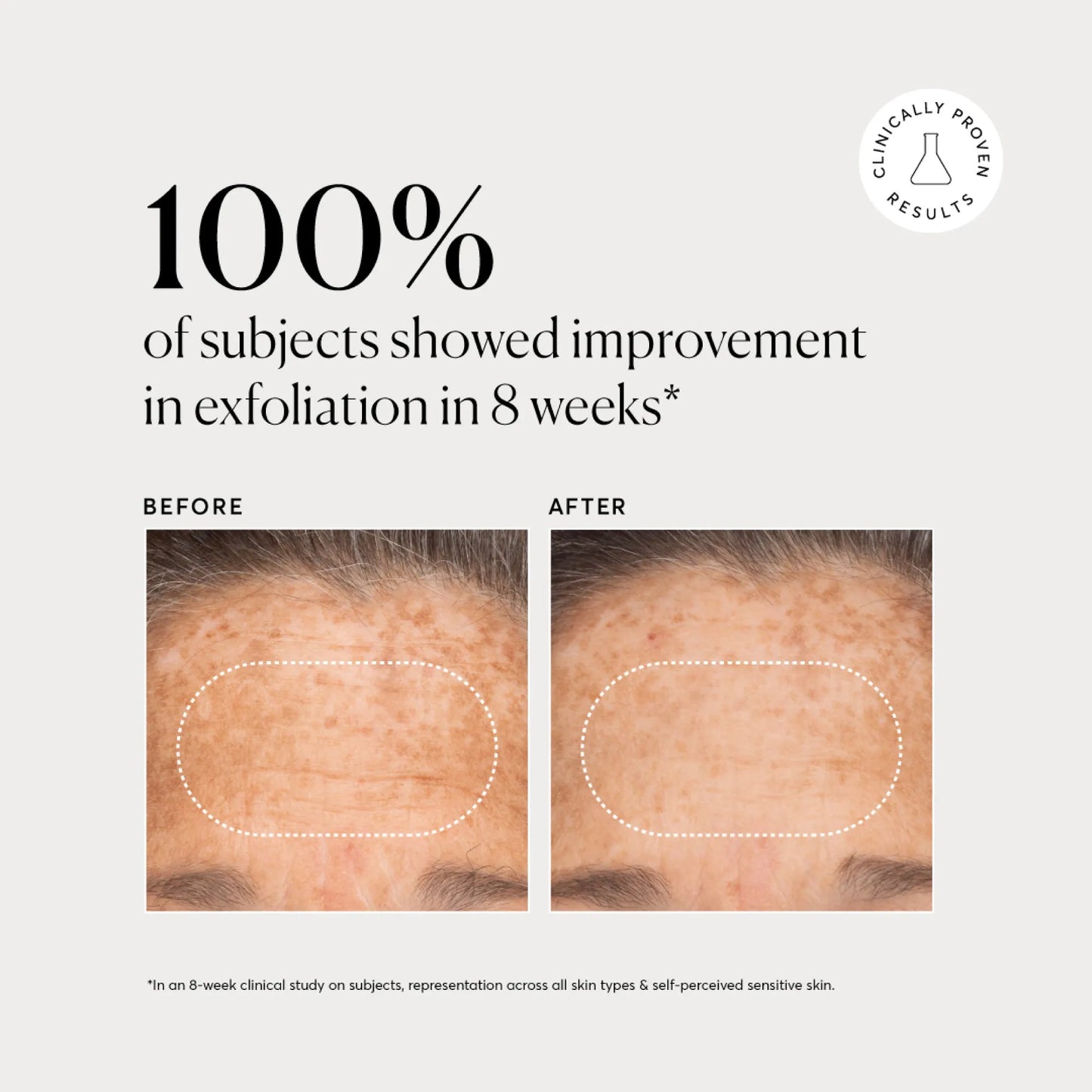 bha-liquid-exfoliant-2-y7 NATR-10027-Alt-Images-BHA-Liquid-Exfoliant-2_-03.webp